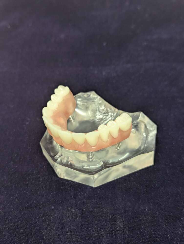 The Models Plus All-on-4 Implant Patient Education Model, showing lower teeth and gums, is displayed on a clear hexagonal base against a dark background.