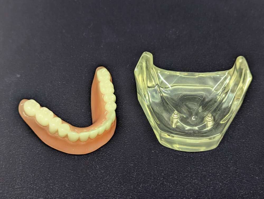 Two dental models by Models Plus: a Ball & O-Ring Implant Patient Education Model with gum-colored base and attachment, and a clear, yellowish model showing two metal posts for implant demonstration.