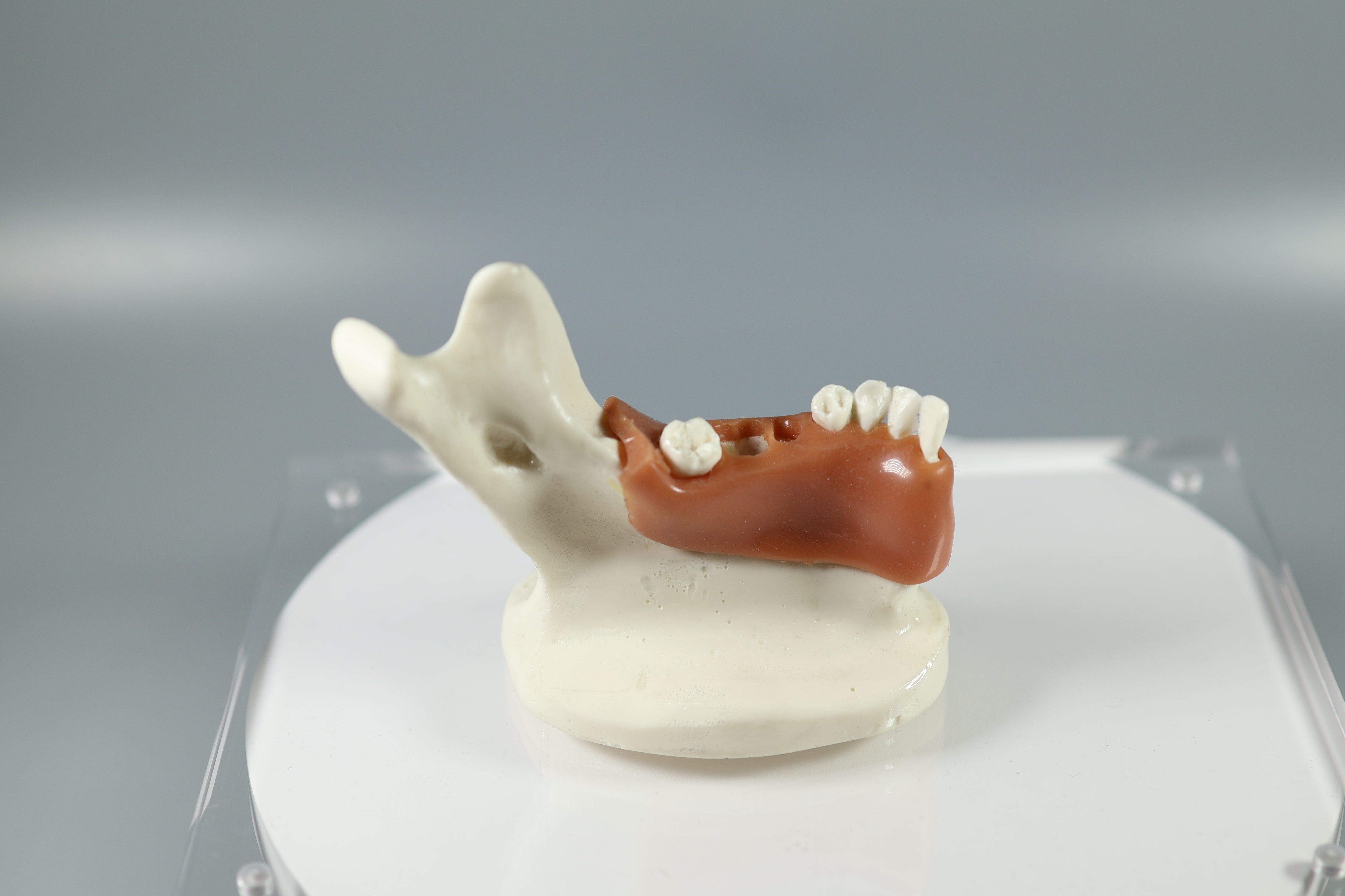 The Models Plus Socket Preservation and Grafting Model displays a partial lower jaw with missing teeth, highlighting socket preservation and bone grafting. Shown on a white base against a plain gray background.