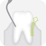 W&H Piezomed Periodontology Tips