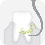 W&H Piezomed Periodontology Tips