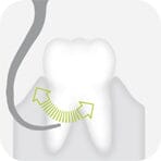 W&H Piezomed Periodontology Tips