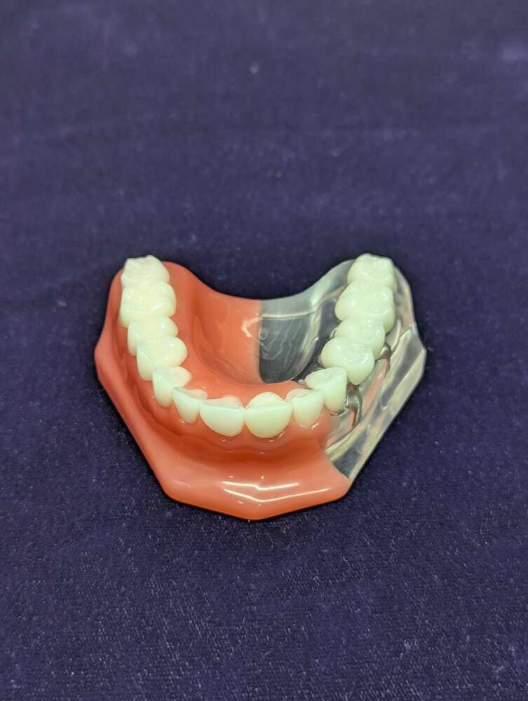 The Models Plus CROWN & BRIDGE IMPLANT MODEL displays artificial lower teeth with pink gums on a dark purple background, perfect for demonstrating implant or crown and bridge procedures.