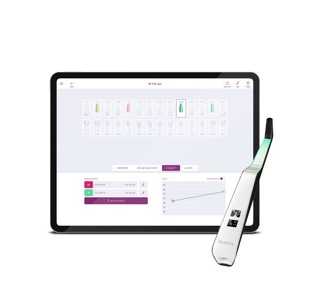 Osstell SmartPegs – Implant-Specific RFA Measurement Pegs