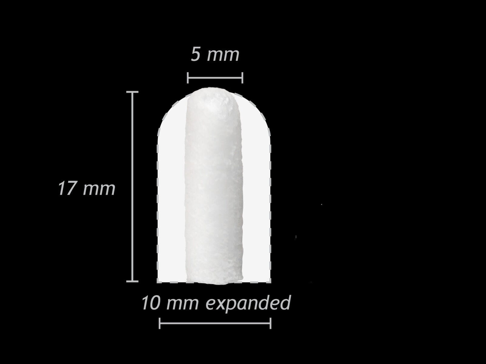 Close up of Zcore Expand plug by Osteogenics featuring imposed image of small size over a large size, with mm measurements illustrating sizes.  